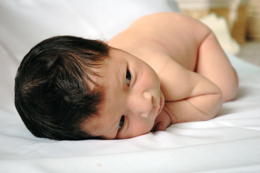 Pitt Hopkins Syndrome | Baby with Pitt Hopkins